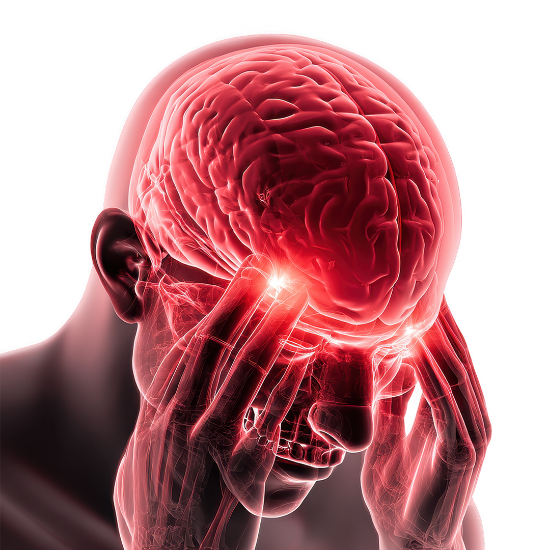 تصویر پیشگیری از سکته مغزی